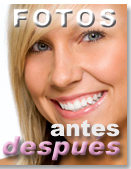 Antes - Despu&eacute;s