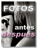 Antes - Despu&eacute;s